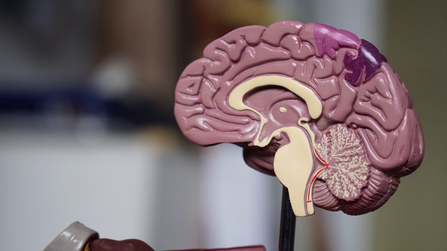 Healthcare Brain Model